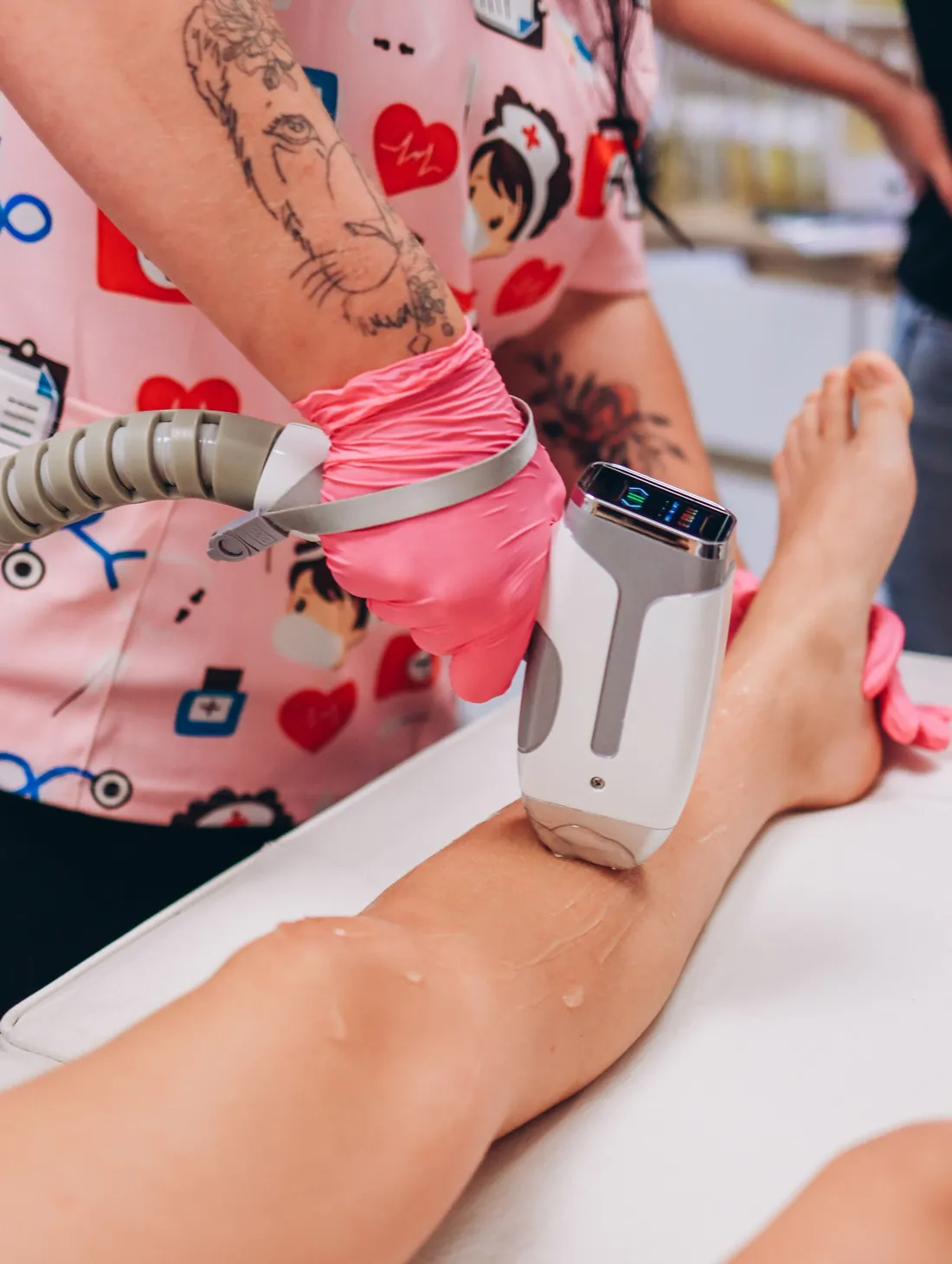 Laser hair removal